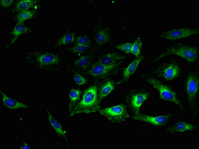 Immunofluorescent analysis of Hela cells using TMEM56 Antibody at dilution of 1:100 and Alexa Fluor 488-congugated AffiniPure Goat Anti-Rabbit IgG(H+L)Rabbit anti-Human TMEM56 Polyclonal Antibody