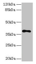 Western blot  | All lanes: TMEM59L antibody at 3µg/ml + 293T whole cell lysate  | Secondary  | Goat polyclonal to rabbit IgG at 1/10000 dilution  | Predicted band size: 38 kDa  | Observed band size: 38 kDaRabbit anti-Human TMEM59L Polyclonal Antibody