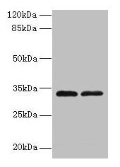 Western blot  | All lanes: TMEM71 antibody at 0.2µg/ml  | Lane 1: U937 whole cell lysate  | Lane 2: U87 whole cell lysate  | Secondary  | Goat polyclonal to rabbit IgG at 1/10000 dilution  | Predicted band size: 33, 31, 27 kDa  | Observed band size: 33 kDaRabbit anti-Human TMEM71 Polyclonal Antibody