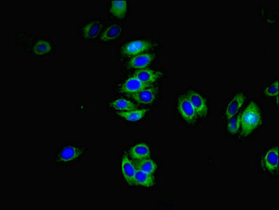 Immunofluorescent analysis of HepG2 cells using TMEM82 Antibody at dilution of 1:100 and Alexa Fluor 488-congugated AffiniPure Goat Anti-Rabbit IgG(H+L)Rabbit anti-Human TMEM82 Polyclonal Antibody