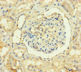 Immunohistochemistry of paraffin-embedded human kidney tissue using the antibody at dilution of 1:100Rabbit anti-Human TMEM82 Polyclonal Antibody