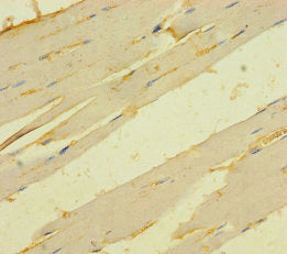 Immunohistochemistry of paraffin-embedded human skeletal muscle tissue using TMEM82 Antibody at dilution of 1:100Rabbit anti-Human TMEM82 Polyclonal Antibody