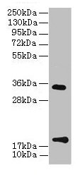 Western Blot  | All lanes: TMEM91 antibody at 16µg/ml + A549 whole cell lysate  | Secondary  | Goat polyclonal to rabbit IgG at 1/10000 dilution  | Predicted band size: 19, 16, 14, 15 kDa  | Observed band size: 19, 34 kDaRabbit anti-Human TMEM91 Polyclonal Antibody