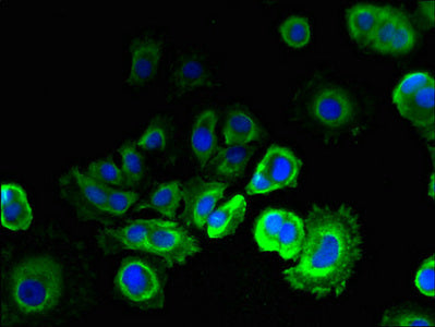 Immunofluorescent analysis of MCF-7 cells using EMC6 Antibody at dilution of 1:100 and Alexa Fluor 488-congugated AffiniPure Goat Anti-Rabbit IgG(H+L)Rabbit anti-Human EMC6 Polyclonal Antibody