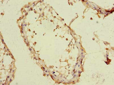 Immunohistochemistry of paraffin-embedded human testis tissue using the antibody at dilution of 1:100Rabbit anti-Human EMC6 Polyclonal Antibody