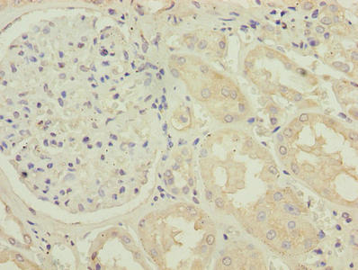 Immunohistochemistry of paraffin-embedded human kidney tissue using TMLHE Antibody at dilution of 1:100