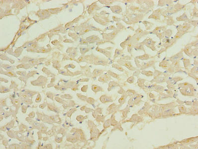 Immunohistochemistry of paraffin-embedded human heart tissue using TMLHE Antibody at dilution of 1:100