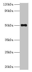 Western blot  | All lanes: TMLHE antibody at 2µg/ml + MCF-7 whole cell lysate  | Secondary  | Goat polyclonal to rabbit IgG at 1/10000 dilution  | Predicted band size: 50, 47, 39, 45, 43, 42, 51 kDa  | Observed band size: 50 kDa