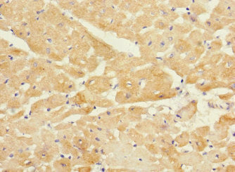 Immunohistochemistry of paraffin-embedded human heart tissue using TMOD1 Antibody at dilution of 1:100Rabbit anti-Human TMOD1 Polyclonal Antibody