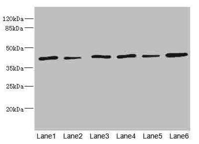 Western blot | All lanes: TMOD1 antibody at 1.85μg/ml | Lane 1: Mouse brain tissue | Lane 2: Mouse lung tissue | Lane 3: Hela whole cell lysate | Lane 4: K562 whole cell lysate | Lane 5: A549 whole cell lysate | Lane 6: MCF-7 whole cell lysate | Secondary | Goat polyclonal to rabbit IgG at 1/10000 dilution | Predicted band size: 41, 27 kDa | Observed band size: 41 kDaRabbit anti-Human TMOD1 Polyclonal Antibody