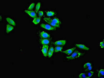Immunofluorescent analysis of HepG2 cells using ENO1 Antibody at dilution of 1:100 and Alexa Fluor 488-congugated AffiniPure Goat Anti-Rabbit IgG(H+L)Rabbit anti-Human ENO1 Polyclonal Antibody