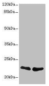 Western blot  | All lanes: TNFAIP8 antibody at 2.32µg/ml  | Lane 1: A431 whole cell lysate  | Lane 2: PC-3 whole cell lysate  | Secondary  | Goat polyclonal to rabbit IgG at 1/10000 dilution  | Predicted band size: 24, 23, 22, 25 kDa  | Observed band size: 22 kDaRabbit anti-Human TNFAIP8 Polyclonal Antibody