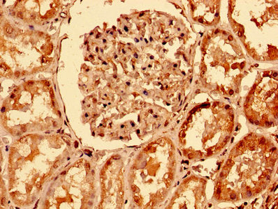 IHC image of TNFRSF10A Antibody diluted at 1:400 and staining in paraffin-embedded human kidney tissue performed on a Leica BondTM system. After dewaxing and hydration, antigen retrieval was mediated by high pressure in a citrate buffer (pH 6.0). Section was blocked with 10% normal goat serum 30min at RT. Then primary antibody (1% BSA) was incubated at 4°C overnight. The primary is detected by a biotinylated secondary antibody and visualized using an HRP conjugated SP system.Rabbit anti-Human TNFRSF10A Polyclonal Antibody