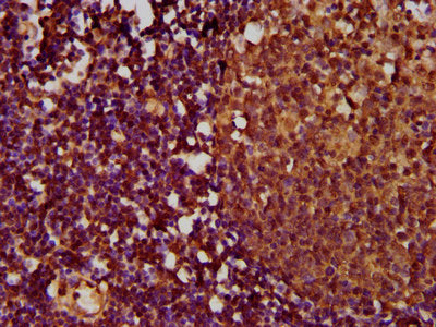 IHC image of TNFRSF18 Antibody diluted at 1:500 and staining in paraffin-embedded human lymph node tissue performed on a Leica BondTM system. After dewaxing and hydration, antigen retrieval was mediated by high pressure in a citrate buffer (pH 6.0). Section was blocked with 10% normal goat serum 30min at RT. Then primary antibody (1% BSA) was incubated at 4°C overnight. The primary is detected by a biotinylated secondary antibody and visualized using an HRP conjugated SP system.Rabbit anti-Human TNFRSF18 Polyclonal Antibody
