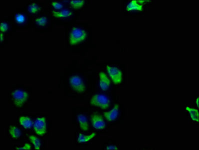 Immunofluorescence staining of Hela cells with TNFRSF1A Antibody at 1:100, counter-stained with DAPI. The cells were fixed in 4% formaldehyde, permeabilized using 0.2% Triton X-100 and blocked in 10% normal Goat Serum. The cells were then incubated with the antibody overnight at 4°C. The secondary antibody was Alexa Fluor 488-congugated AffiniPure Goat Anti-Rabbit IgG(H+L).Rabbit anti-Human TNFRSF1A Polyclonal Antibody