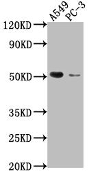 Western Blot | Positive WB detected in: A549 whole cell lysate, PC-3 whole cell lysate | All lanes: TNFRSF1A antibody at 1:2000 | Secondary | Goat polyclonal to rabbit IgG at 1/50000 dilution | Predicted band size: 51, 39, 26, 25 kDa | Observed band size: 51 kDaRabbit anti-Human TNFRSF1A Polyclonal Antibody
