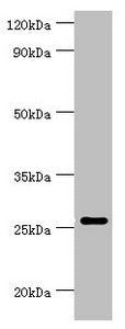 Western blot | All lanes: Tumor necrosis factor ligand superfamily member 13 antibody at 10μg/ml + Hela whole cell lysate | Secondary | Goat polyclonal to rabbit IgG at 1/10000 dilution | Predicted band size: 28, 26, 25, 37, 23 kDa | Observed band size: 28 kDa