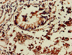 Immunohistochemistry of paraffin-embedded human appendix tissue using the antibody at dilution of 1:100Rabbit anti-Human TNIK Polyclonal Antibody