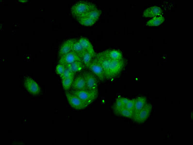 Immunofluorescence staining of HepG2 cells with TNKS Antibody at 1:133, counter-stained with DAPI. The cells were fixed in 4% formaldehyde, permeabilized using 0.2% Triton X-100 and blocked in 10% normal Goat Serum. The cells were then incubated with the antibody overnight at 4°C. The secondary antibody was Alexa Fluor 488-congugated AffiniPure Goat Anti-Rabbit IgG(H+L).Rabbit anti-Human TNKS Polyclonal Antibody