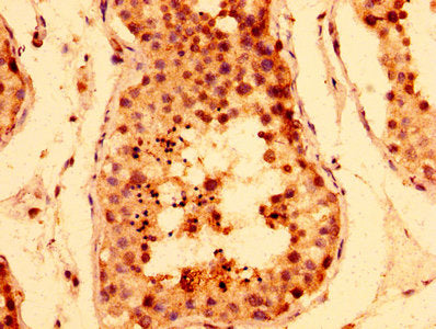 IHC image of TNKS Antibody diluted at 1:400 and staining in paraffin-embedded human testis tissue performed on a Leica BondTM system. After dewaxing and hydration, antigen retrieval was mediated by high pressure in a citrate buffer (pH 6.0). Section was blocked with 10% normal goat serum 30min at RT. Then primary antibody (1% BSA) was incubated at 4°C overnight. The primary is detected by a biotinylated secondary antibody and visualized using an HRP conjugated SP system.Rabbit anti-Human TNKS Polyclonal Antibody