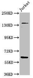 Western Blot  | Positive WB detected in: Jurkat whole cell lysate  | All lanes: TNKS antibody at 4.8µg/ml  | Secondary  | Goat polyclonal to rabbit IgG at 1/50000 dilution  | Predicted band size: 143, 68 kDa  | Observed band size: 143, 68 kDaRabbit anti-Human TNKS Polyclonal Antibody
