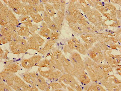 Immunohistochemistry of paraffin-embedded human heart tissue using TNNC1 Antibody at dilution of 1:100Rabbit anti-Human TNNC1 Polyclonal Antibody