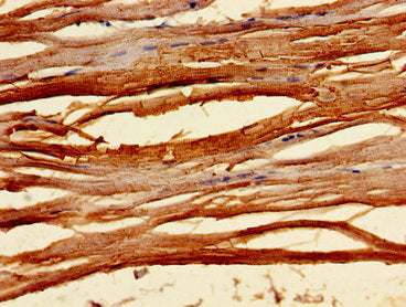 Immunohistochemistry of paraffin-embedded human skeletal muscle tissue using TNNC1 Antibody at dilution of 1:100Rabbit anti-Human TNNC1 Polyclonal Antibody