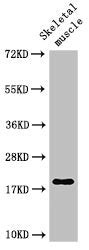 Western Blot | Positive WB detected in: Rat skeletal muscle tissue | All lanes: TNNC1 antibody at 3μg/ml | Secondary | Goat polyclonal to rabbit IgG at 1/50000 dilution | Predicted band size: 19 kDa | Observed band size: 19 kDaRabbit anti-Human TNNC1 Polyclonal Antibody