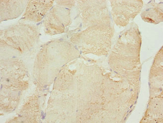 Immunohistochemistry of paraffin-embedded human skeletal muscle tissue using TNNI2 Antibody at dilution of 1:100Rabbit anti-Human TNNI2 Polyclonal Antibody