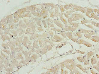 Immunohistochemistry of paraffin-embedded human heart tissue using TNNI2 Antibody at dilution of 1:100Rabbit anti-Human TNNI2 Polyclonal Antibody