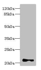 Western blot | All lanes: TNNI2 antibody at 3.83μg/ml + Mouse skeletal muscle tissue | Secondary | Goat polyclonal to rabbit IgG at 1/10000 dilution | Predicted band size: 21 kDa | Observed band size: 21 kDaRabbit anti-Human TNNI2 Polyclonal Antibody