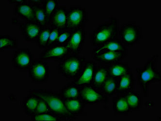 Immunofluorescent analysis of A549 cells using TOB1 Antibody at dilution of 1:100 and Alexa Fluor 488-congugated AffiniPure Goat Anti-Rabbit IgG(H+L)Rabbit anti-Human TOB1 Polyclonal Antibody