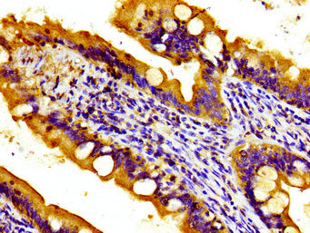 Immunohistochemistry of paraffin-embedded human small intestine tissue using TOB1 Antibody at dilution of 1:100Rabbit anti-Human TOB1 Polyclonal Antibody