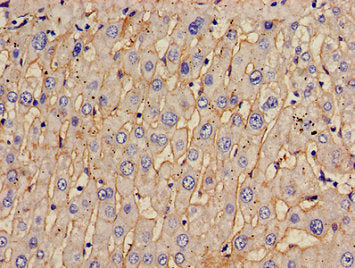 Immunohistochemistry of paraffin-embedded human liver tissue using TOM1 Antibody at dilution of 1:100Rabbit anti-Human TOM1 Polyclonal Antibody