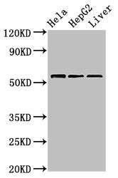 Western Blot  | Positive WB detected in: Hela whole cell lysate, HepG2 whole cell lysate, Mouse liver tissue  | All lanes: TOM1 antibody at 2.4µg/ml  | Secondary  | Goat polyclonal to rabbit IgG at 1/50000 dilution  | Predicted band size: 54, 49, 51 kDa  | Observed band size: 54 kDaRabbit anti-Human TOM1 Polyclonal Antibody