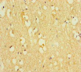 Immunohistochemistry of paraffin-embedded human brain tissue using TOX3 Antibody at dilution of 1:100Rabbit anti-Human TOX3 Polyclonal Antibody