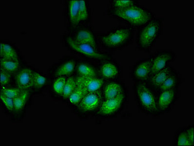 Immunofluorescent analysis of HepG2 cells using TPD52L2 Antibody at dilution of 1:100 and Alexa Fluor 488-congugated AffiniPure Goat Anti-Rabbit IgG(H+L)Rabbit anti-Human TPD52L2 Polyclonal Antibody