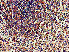 Immunohistochemistry of paraffin-embedded human spleen tissue using TPD52L2 Antibody at dilution of 1:100Rabbit anti-Human TPD52L2 Polyclonal Antibody