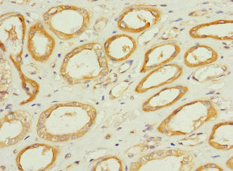 Immunohistochemistry of paraffin-embedded human kidney tissue using TPK1 Antibody at dilution of 1:100Rabbit anti-Human TPK1 Polyclonal Antibody