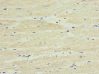 Immunohistochemistry of paraffin-embedded human heart tissue using TPK1 Antibody at dilution of 1:100Rabbit anti-Human TPK1 Polyclonal Antibody
