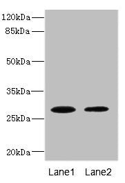 Western blot | All lanes: TPK1 antibody at 0.78μg/ml | Lane 1: Mouse liver tissue | Lane 2: Mouse kidney tissue | Secondary | Goat polyclonal to rabbit IgG at 1/10000 dilution | Predicted band size: 28, 14 kDa | Observed band size: 28 kDaRabbit anti-Human TPK1 Polyclonal Antibody