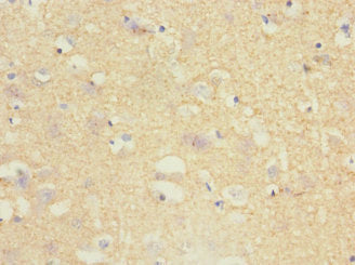 Immunohistochemistry of paraffin-embedded human brain tissue using TPPP Antibody at dilution of 1:100Rabbit anti-Human TPPP Polyclonal Antibody