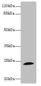 Western blot | All lanes: TPPP antibody IgG at 1.71μg/ml + Mouse brain tissue | Secondary | Goat polyclonal to rabbit IgG at 1/10000 dilution | Predicted band size: 24 kDa | Observed band size: 24 kDaRabbit anti-Human TPPP Polyclonal Antibody