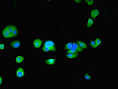 Immunofluorescent analysis of MCF-7 cells using TPPP2 Antibody at dilution of 1:100 and Alexa Fluor 488-congugated AffiniPure Goat Anti-Rabbit IgG(H+L)Rabbit anti-Human TPPP2 Polyclonal Antibody