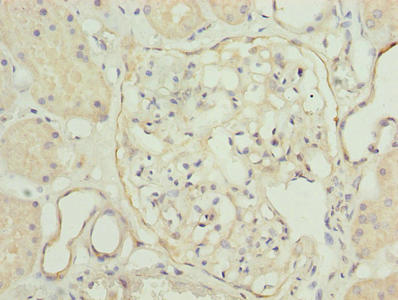 Immunohistochemistry of paraffin-embedded human kidney tissue using TPPP2 Antibody at dilution of 1:100Rabbit anti-Human TPPP2 Polyclonal Antibody