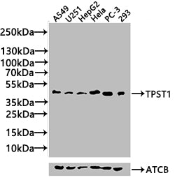 Western Blot | Positive WB detected in: Rat liver tissue, Mouse liver tissue, Mouse kidney tissue | All lanes: TPST1 antibody at 2.4μg/ml | Secondary | Goat polyclonal to rabbit IgG at 1/50000 dilution | Predicted band size: 43 kDa | Observed band size: 50 kDaRabbit anti-Human TPST1 Polyclonal Antibody