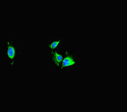 Immunofluorescent analysis of Hela cells using TRAF2 Antibody at dilution of 1:100 and Alexa Fluor 488-congugated AffiniPure Goat Anti-Rabbit IgG(H+L)Rabbit anti-Human TRAF2 Polyclonal Antibody