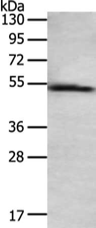 Gel: 8%SDS-PAGE, Lysate: 40 μg, Lane: Human normal liver tissue, Primary antibody: TAT Antibody(TAT Antibody) at dilution 1/200 dilution, Secondary antibody: Goat anti rabbit IgG at 1/8000 dilution, Exposure time: 3 minutesRabbit anti-Human TAT Polyclonal Antibody