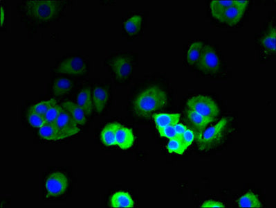 Immunofluorescent analysis of MCF-7 cells using TRBC1 Antibody at dilution of 1:100 and Alexa Fluor 488-congugated AffiniPure Goat Anti-Rabbit IgG(H+L)Rabbit anti-Human TRBC1 Polyclonal Antibody