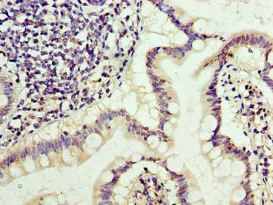 Immunohistochemistry of paraffin-embedded human small intestine tissue using TRBC1 Antibody at dilution of 1:100Rabbit anti-Human TRBC1 Polyclonal Antibody